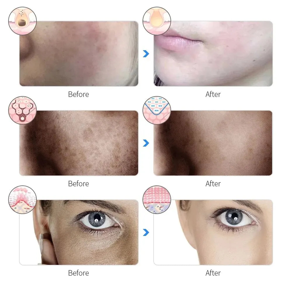 7 Colors LED Red Light Photon Therapy Facial Mask