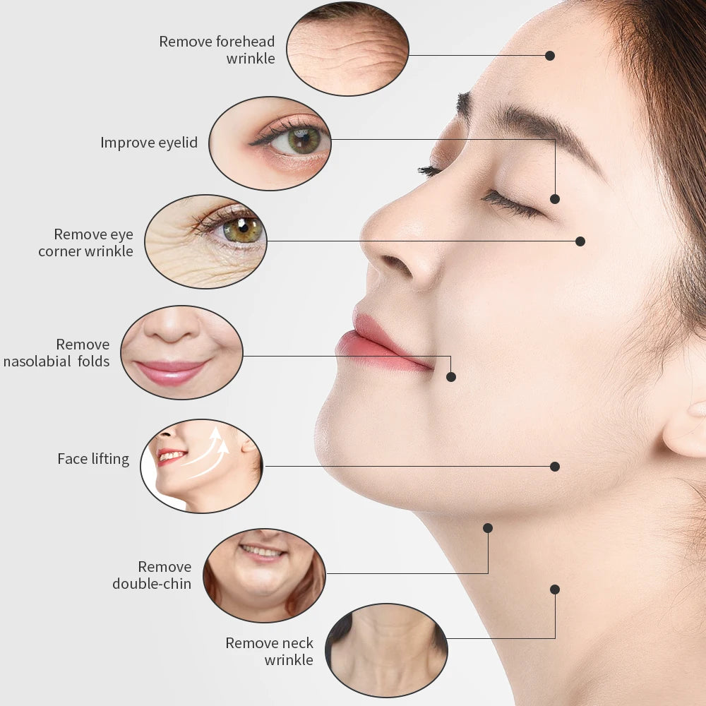 2MHz Tripolar Radio Frequency Face Care Machine