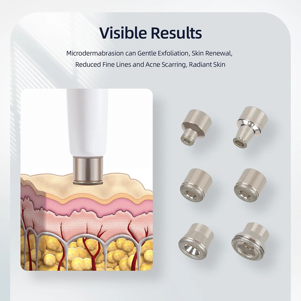 Diamond Facial Peeling Machine Home Use