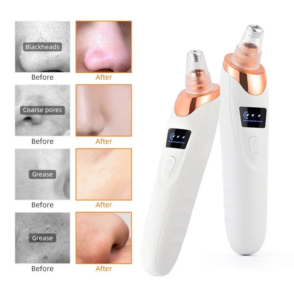 Nose Blackhead Remover Face Cleansing Machine