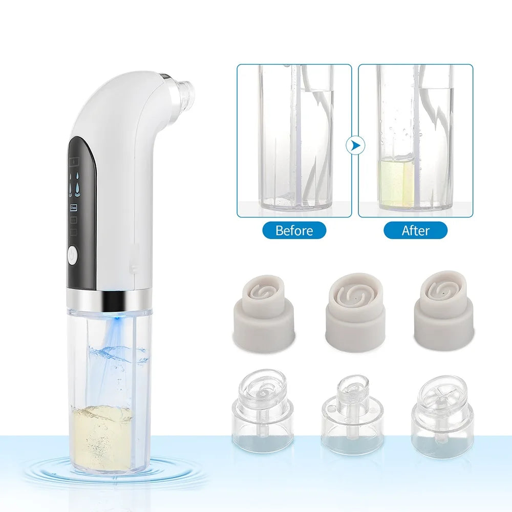 Small Bubble Blackhead Remover Facial Cleansing