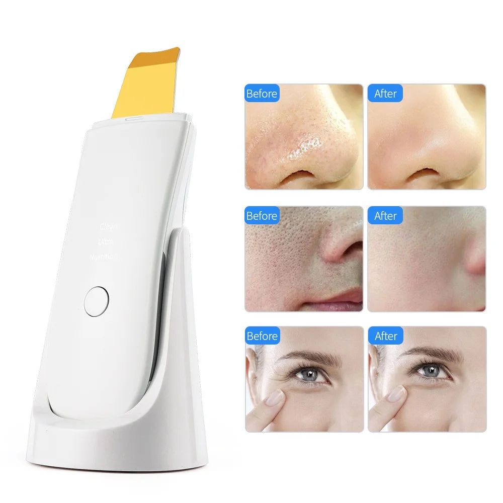 24kHz Ultrasonic Skin Scrubber
