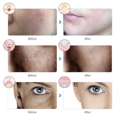 7 Colors LED Red Light Photon Therapy Facial Mask