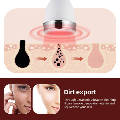 Ultrasound Skin Care High Frequency Face Eye Massager