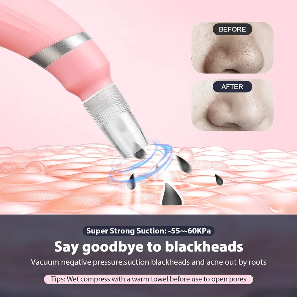 Portable Diamond Peeling Machine