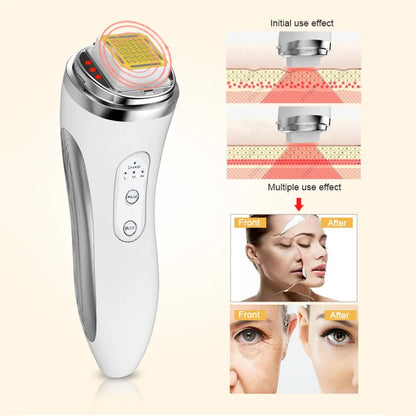 RF Face Lifting Anti Aging Skin Tightening Beauty Device