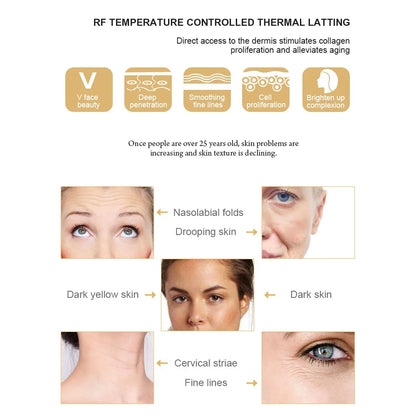 RF Face Lifting Anti Aging Skin Tightening Beauty Device