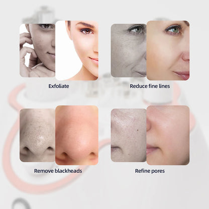 Diamond Facial Peeling Machine Home Use