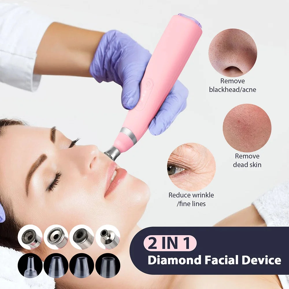 Portable Diamond Peeling Machine