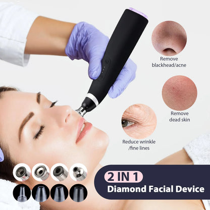 Portable Diamond Peeling Machine